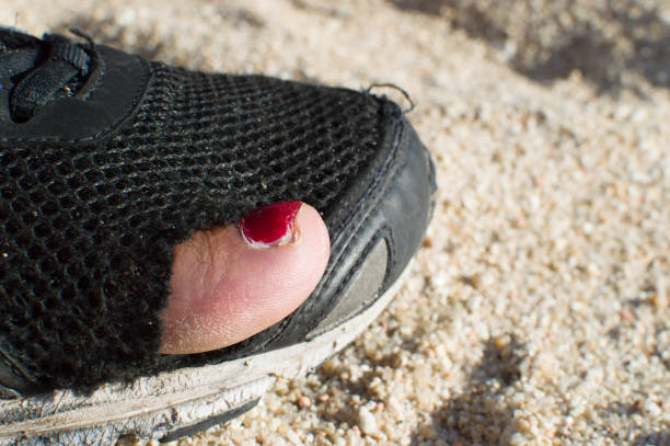 Damaged Shoe hole repairing by putting sticker and Raffu
